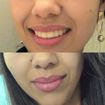 Micropigmentação#boca#contornolabial#