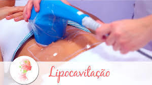LIPO SEM CORTE OU LIPOCAVITAÇÃO : tratamento que rompe as células de gordura através do calor. Eficiente para quem não quer passar pelos riscos de uma cirurgia plástica. Reduz de 4 a 6 cm por aplicação. São necessárias em média 5 sessões que serão realizadas 1x/semana. fisioterapeuta