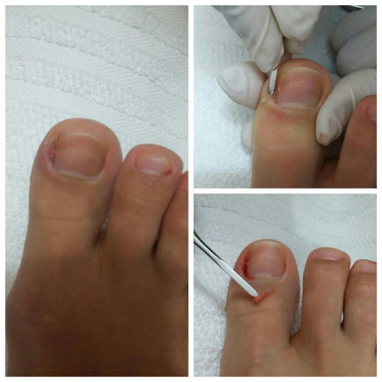 podólogo(a) manicure e pedicure
