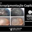 #micropigmentaçaocapilar
Venha fazer seu curso de Micropigmentação Capilar com o especialista em micropigmentação.
Aprenda as técnicas mais modernas e com os melhores resultados: 
- Técnica Cabelo Raspado
- Técnica Fio-a-Fio Realista
- Técnica Preenchimento Suave Natural
- Técnica Preenchimento Denso Natural
Não perca mais tempo, informações e matriculas: 41 3265.0965 | 9583.8300 (whats) 