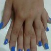 Acrigel
