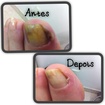 Desinfeção antes e depois do procedimento .