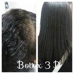#Botox 