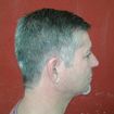 Corte social.