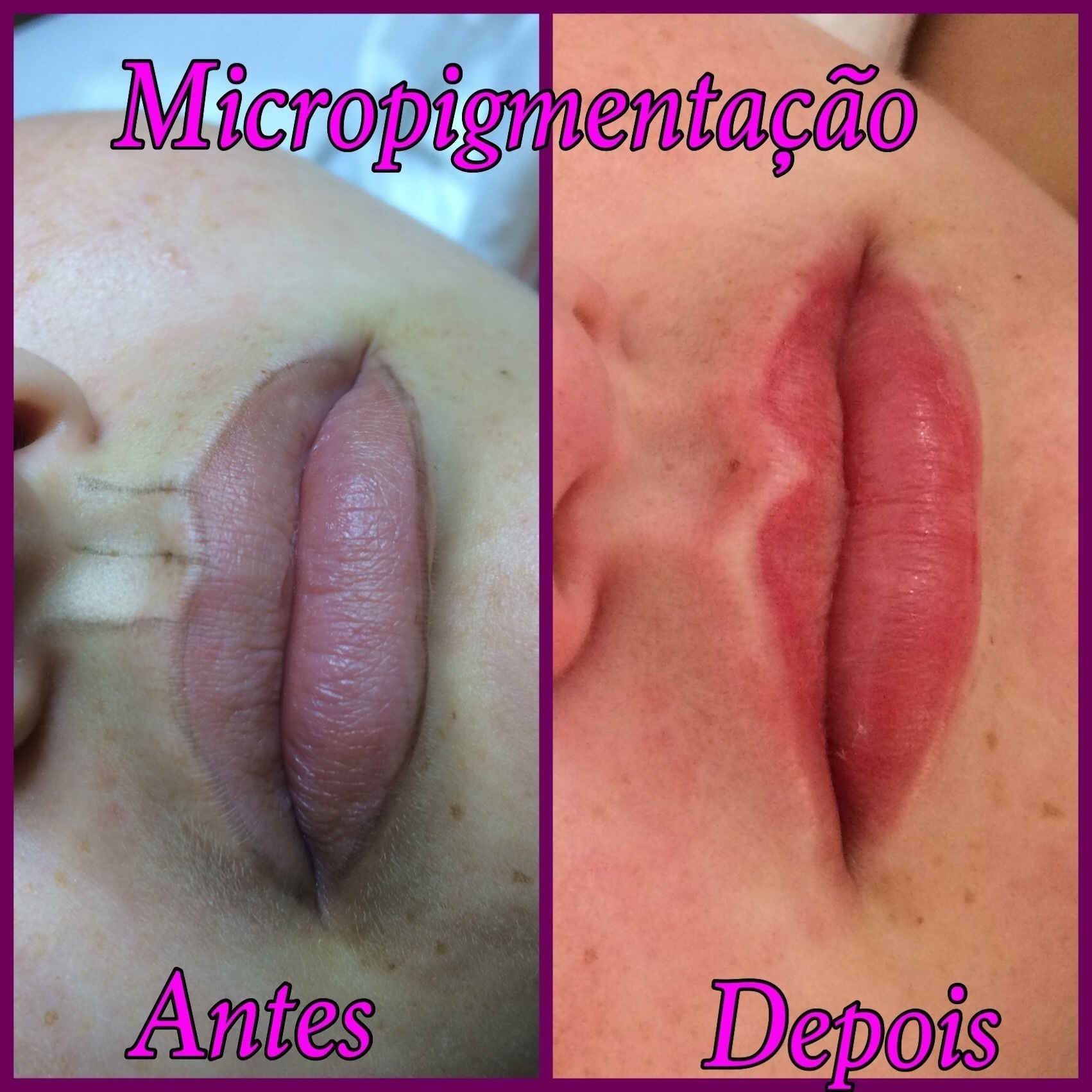 Micropigmentação contorno de boca com preenchimento  estética designer de sobrancelhas depilador(a) micropigmentador(a)