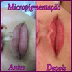 Micropigmentação contorno de boca com preenchimento 