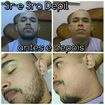Depilação de barba masculina na cera quente😱