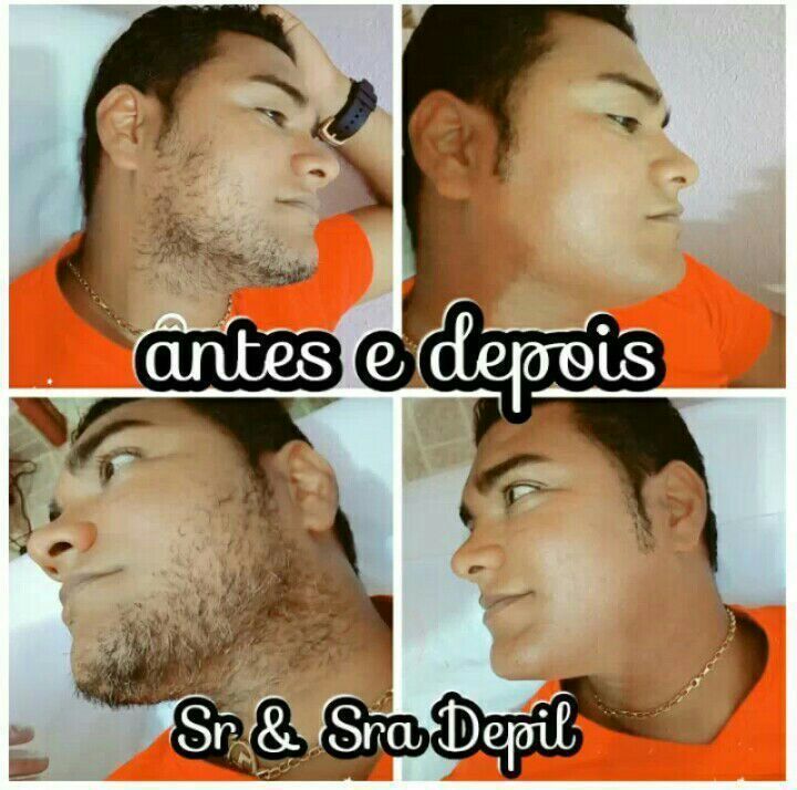 Foto Depila o de barba masculina finalizada na linha CBeauty