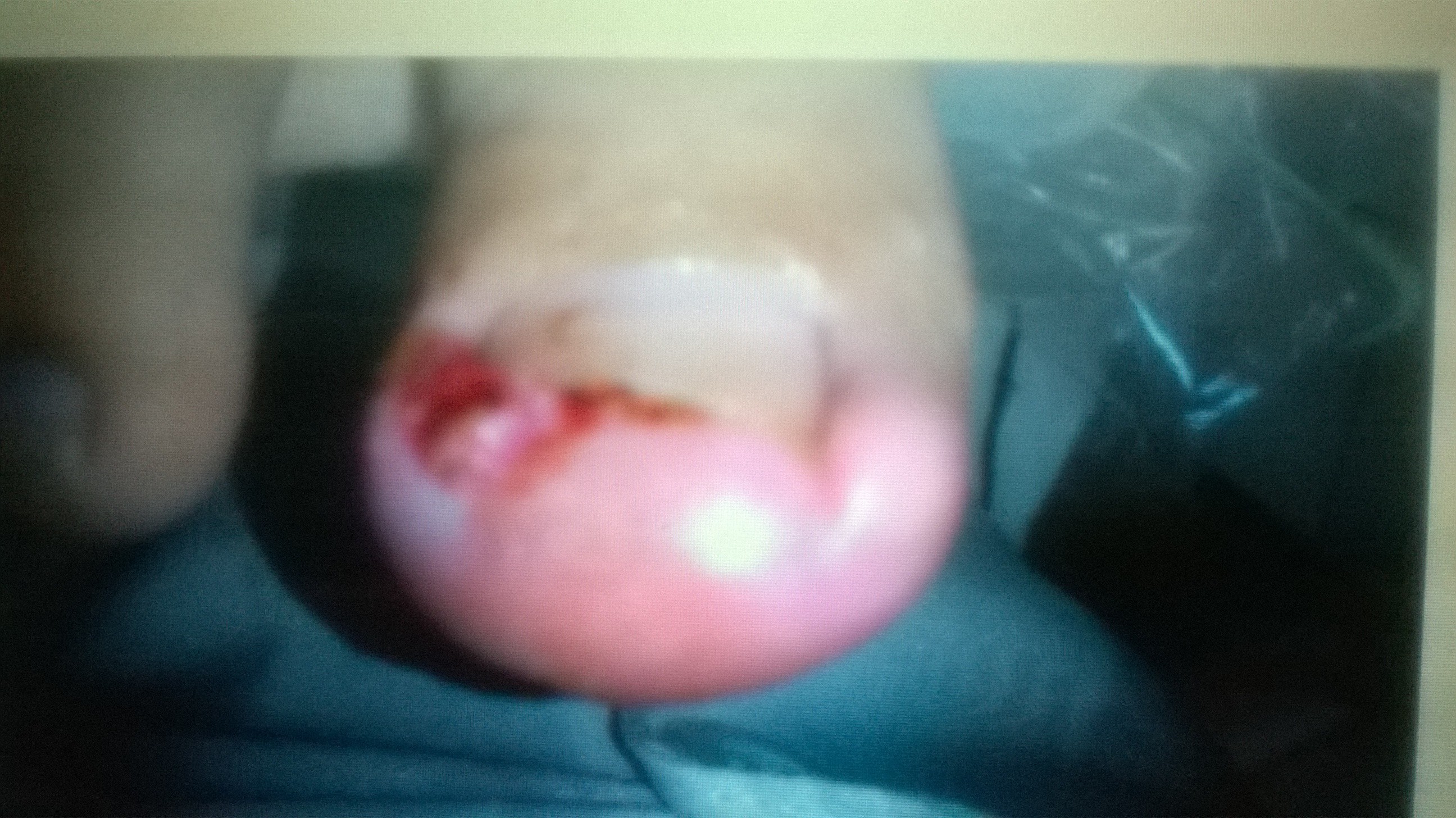 Infecções. unha podólogo(a) manicure e pedicure