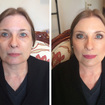 Antes e depois - maquiagem natural. #nataliafragamakeup