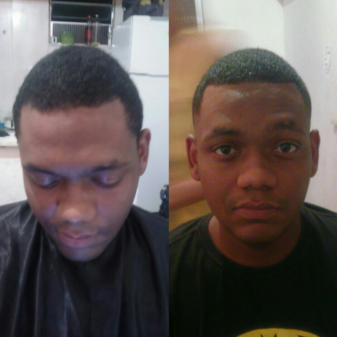 Antes e depois. Medium skin fade.💈 cabelo barbeiro(a)