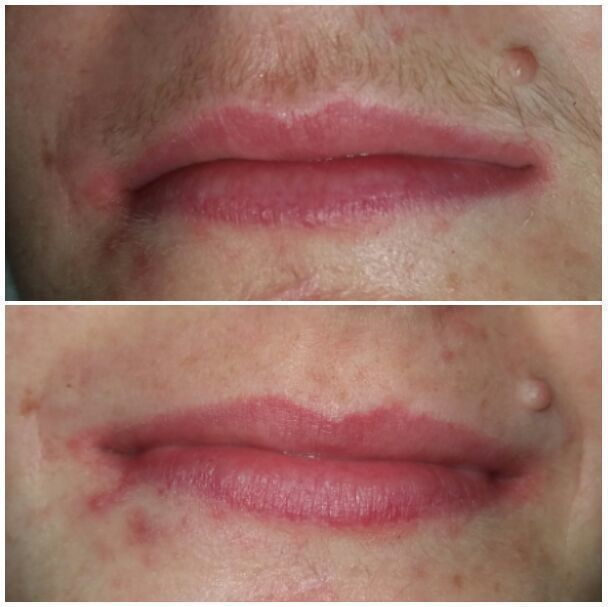 Depilação egípcia estética micropigmentador(a) dermopigmentador(a) outros