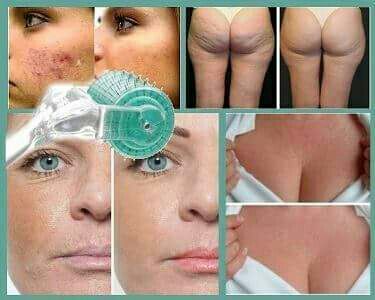 Microagulhamento  e Micropuntura estética dermopigmentador(a) dermopigmentador(a)