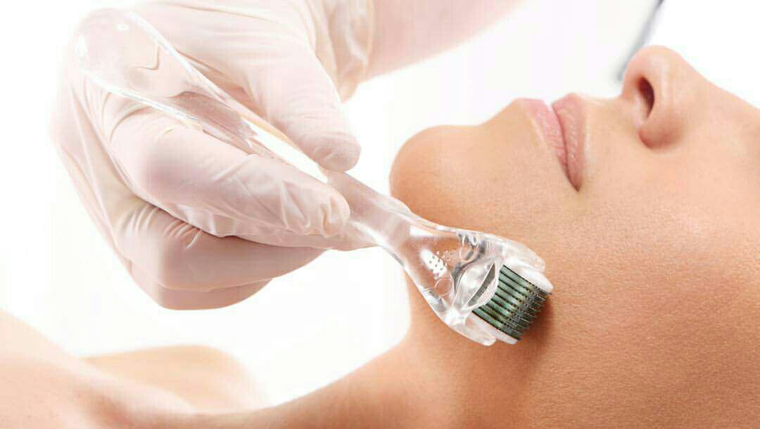 Tratamentos faciais com e sem microagulhamento  e PEELING  para o ano todo dermopigmentador(a) dermopigmentador(a)