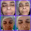 Designer de sobrancelhas