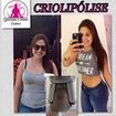 Antes e depois dos procedimentos de criolipólise, drenagem linfática e massagem modeladora.