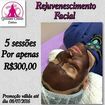 Rejuvenescimento facial, finalizado com máscara de cafe e cacau