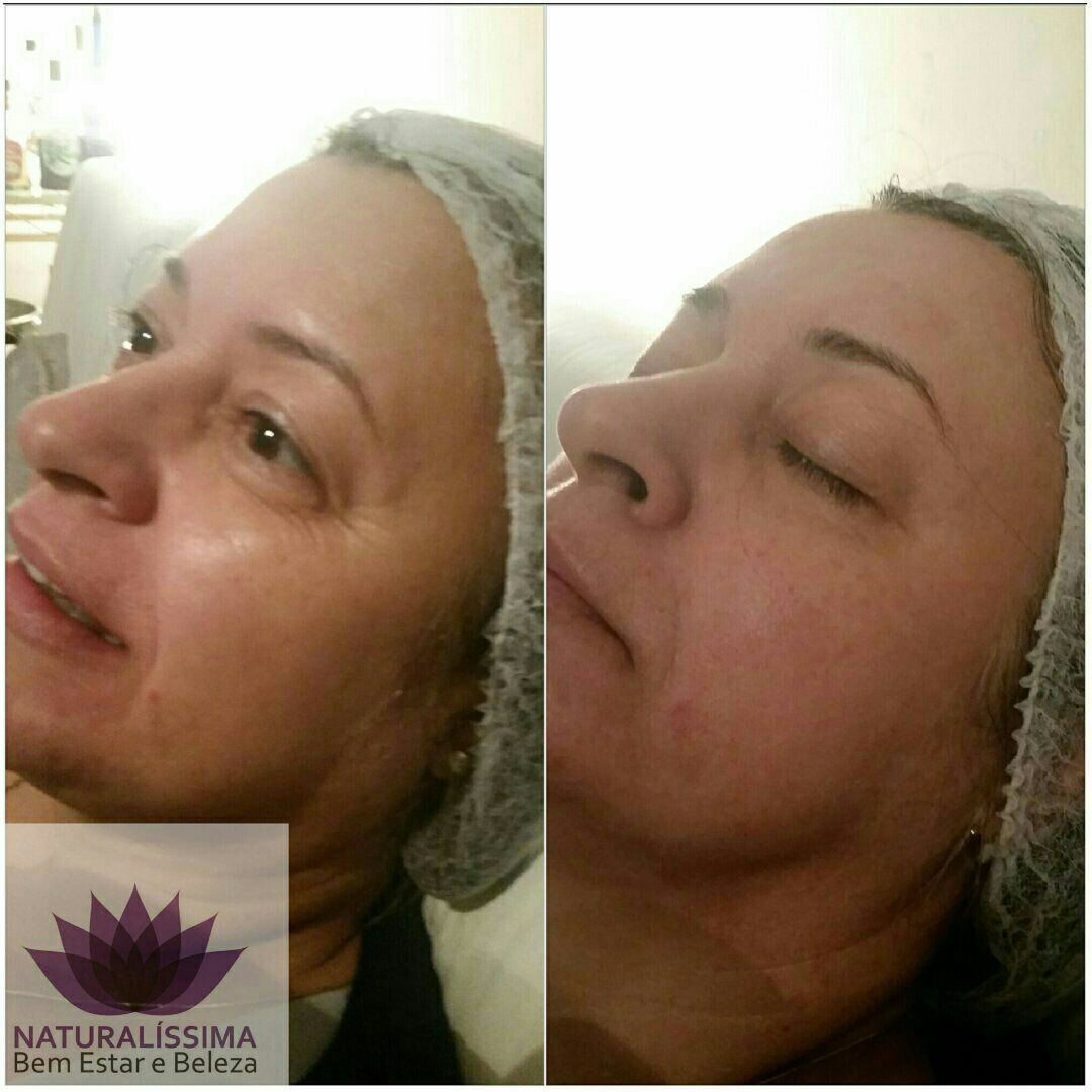 Limpeza de pele com hidratação e máscara tensora cosmetólogo(a) esteticista aromaterapeuta