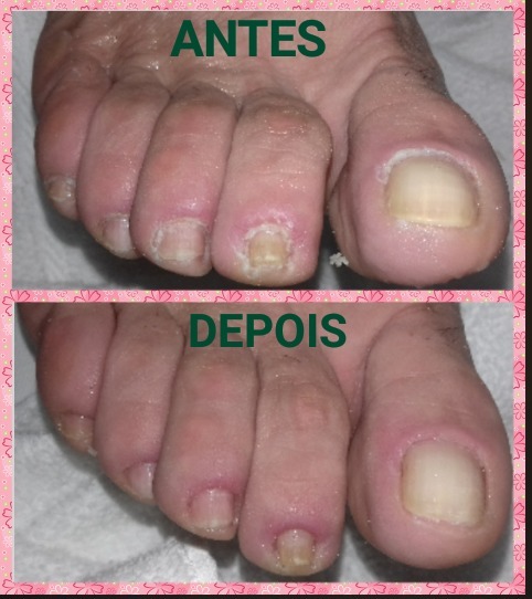 podólogo(a) manicure e pedicure