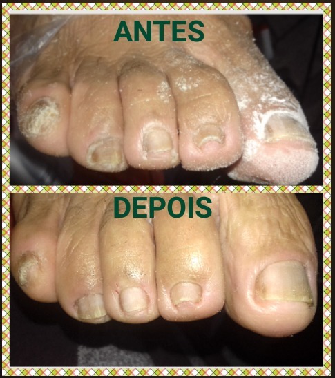 podólogo(a) manicure e pedicure