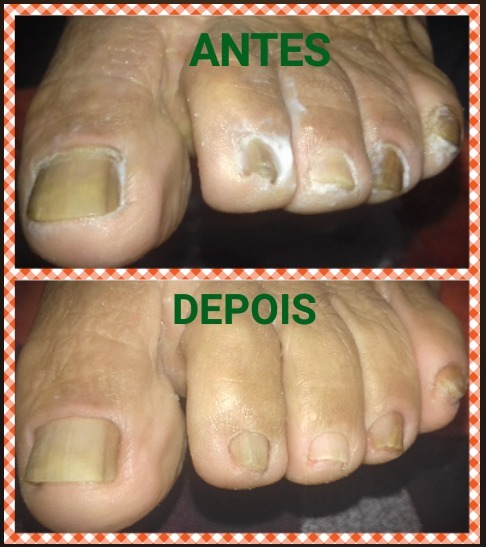 podólogo(a) manicure e pedicure