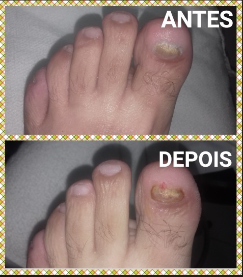 podólogo(a) manicure e pedicure