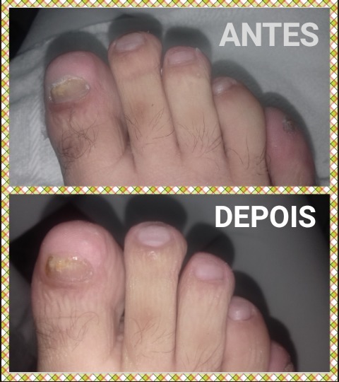 podólogo(a) manicure e pedicure