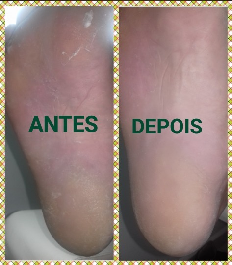 podólogo(a) manicure e pedicure
