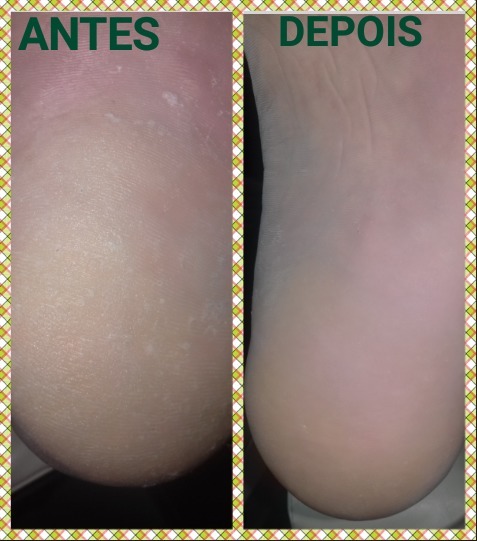 podólogo(a) manicure e pedicure