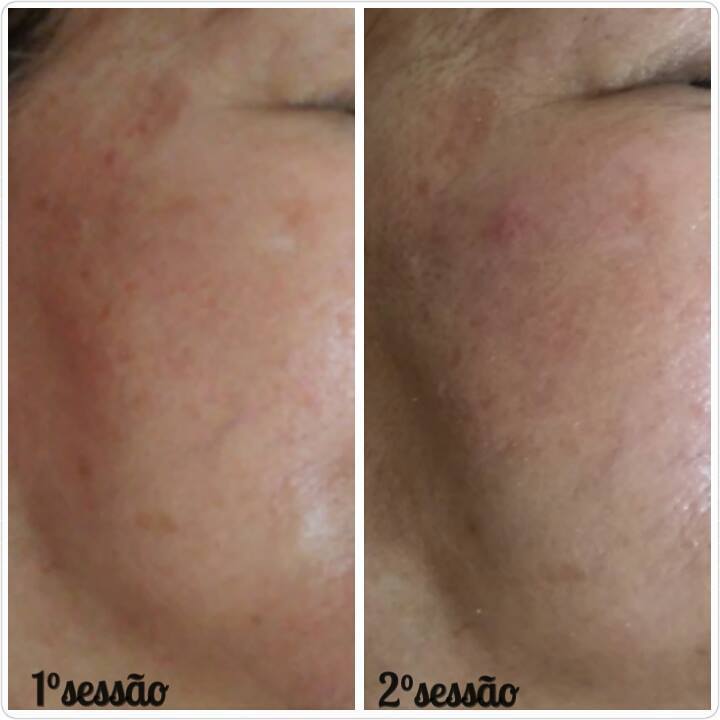estética massoterapeuta