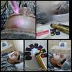 Cromoterapia estética