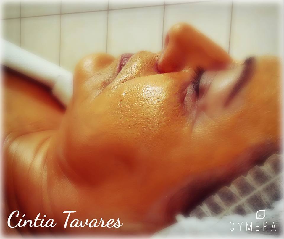Peeling Facial estética massoterapeuta