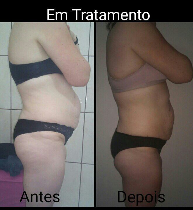 estética massoterapeuta