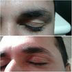 Limpeza sobrancelha masculina 👦
A claridade não ajudou muito