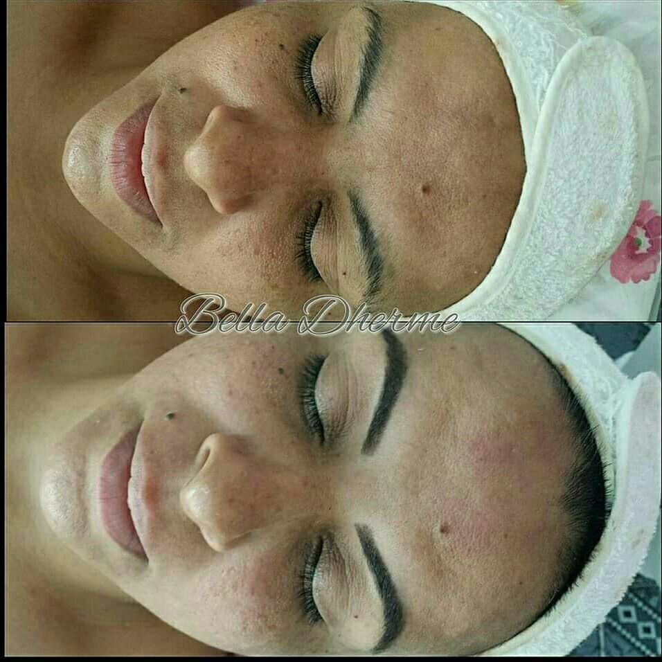 Limpeza de Pele + Design com aplicação da henna e depilação do buço. estética micropigmentador(a) designer de sobrancelhas