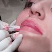 Micropigmentação de contorno de lábios