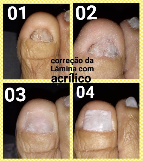 Mais um trabalhinho ♡♡♡ estética podólogo(a) manicure e pedicure
