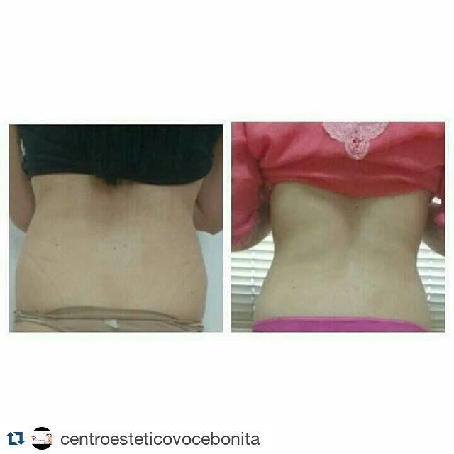 Antes /depois, tratamento para perda de medidas.  estética esteticista micropigmentador(a) designer de sobrancelhas depilador(a)