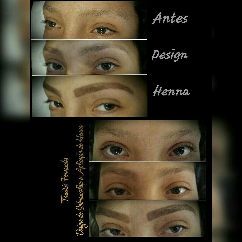 esteticista