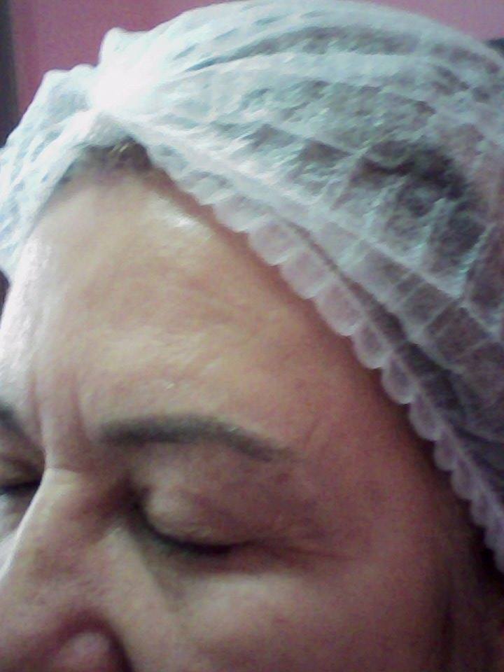 Micro pigmentação  sobrancelha antes estética esteticista cosmetólogo(a) consultor(a) outros