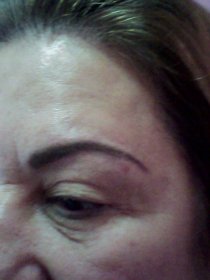 Micro pigmentação depois- Sobrancelha estética esteticista cosmetólogo(a) consultor(a) outros