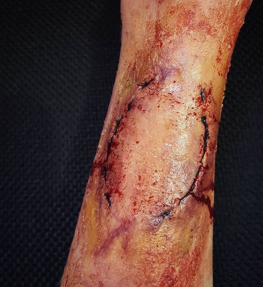 Mordida de zumbi usando scar war, latex e maquiagem. 
#halloween #zombiebite maquiagem
