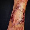 Mordida de zumbi usando scar war, latex e maquiagem. 
#halloween #zombiebite