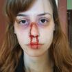 Nariz quebrado feito com scar war. 
#brokennose #sfxmakeup #makeupartist