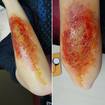 Ralado e sujo. Usei latex para a textura, maquiagem e sangue falso.
#sfxmakeup 