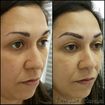 Transformando olhares...
Micropigmentação de Sobrancelhas 
Técnica Microblanding Fio a Fio