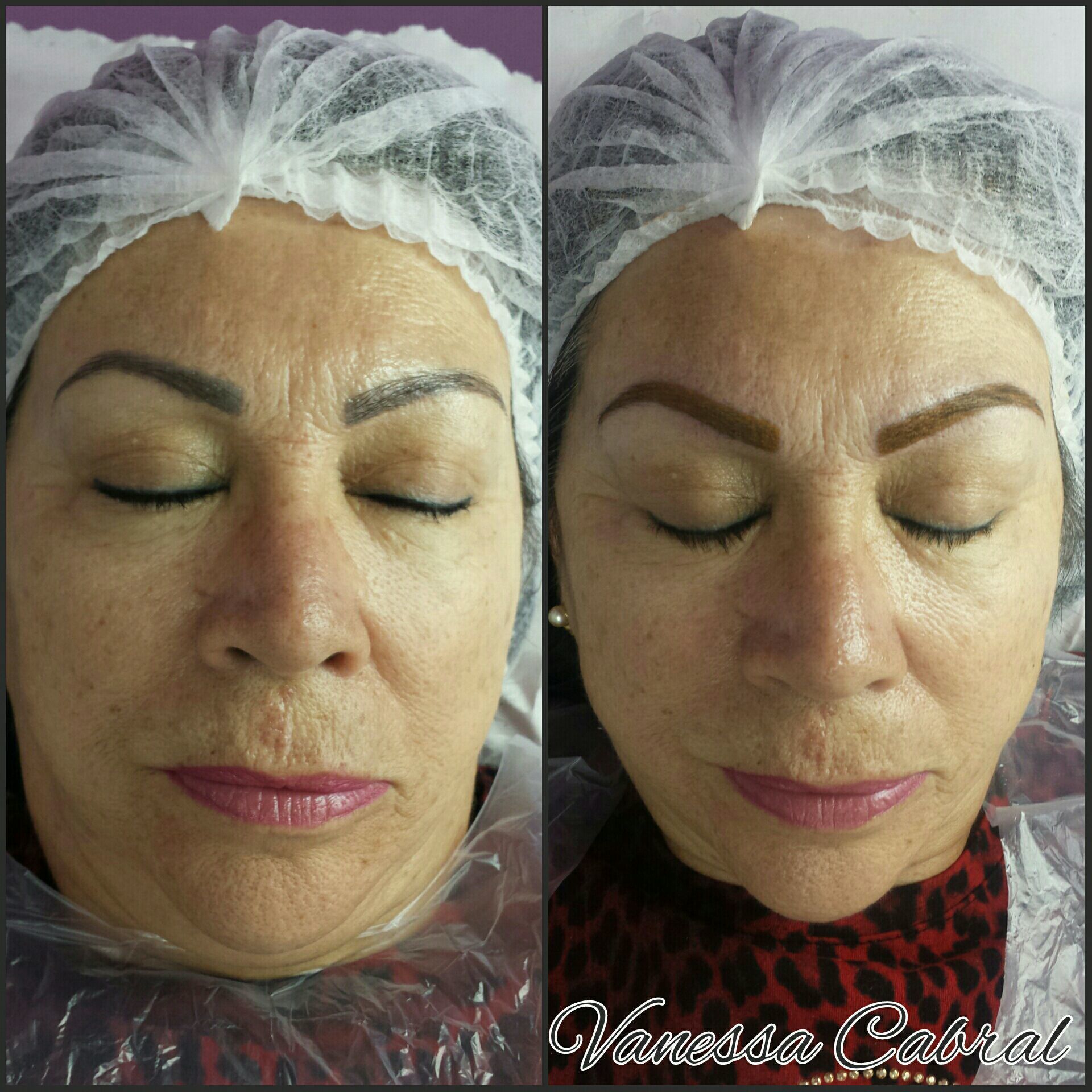 Técnica de Neutralização de cor Cinza em Sobrancelhas.
Após a cicatrização as sobrancelhas voltarão com uma cor marrom. Podendo assim, fazer a técnica de fio a fio ou Esfumada, melhorando o desenho. outros micropigmentador(a) designer de sobrancelhas