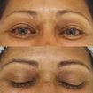 Microblading