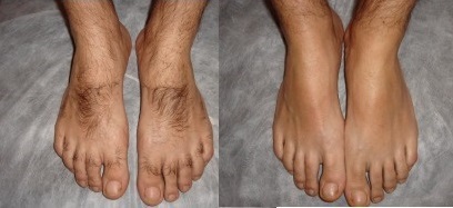 estética depilador(a) esteticista