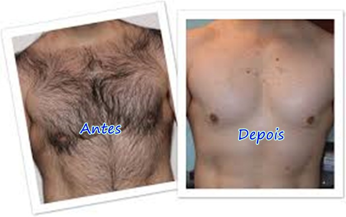 estética depilador(a) esteticista